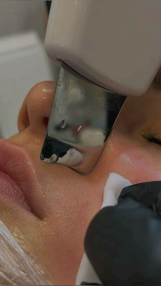 ✨ Appareil Ultrasonique de Nettoyage du Visage. Une peau propre, lisse et éclatante en quelques minutes à la maison !